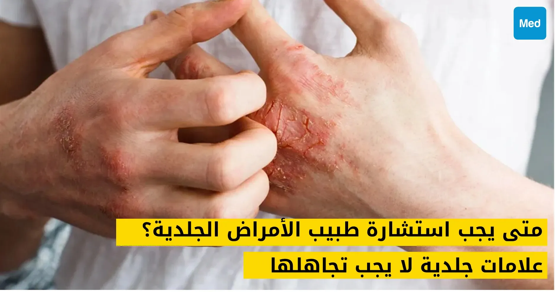 متى يجب استشارة طبيب الأمراض الجلدية؟ علامات جلدية لا يجب تجاهلها